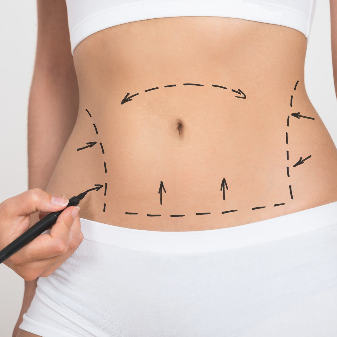 Body Contouring - Lymph Bright