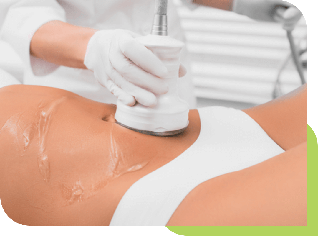 Image of body contouring