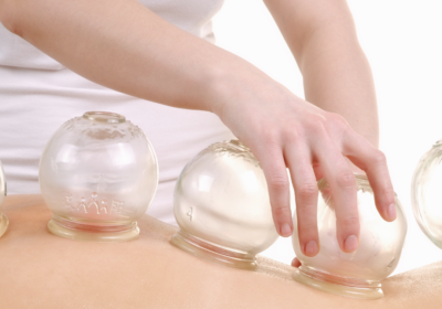 image of a woman getting a cup massage